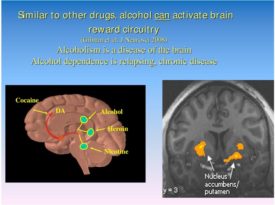 J Neurosci 2008) Alcoholism is a disease of the brain