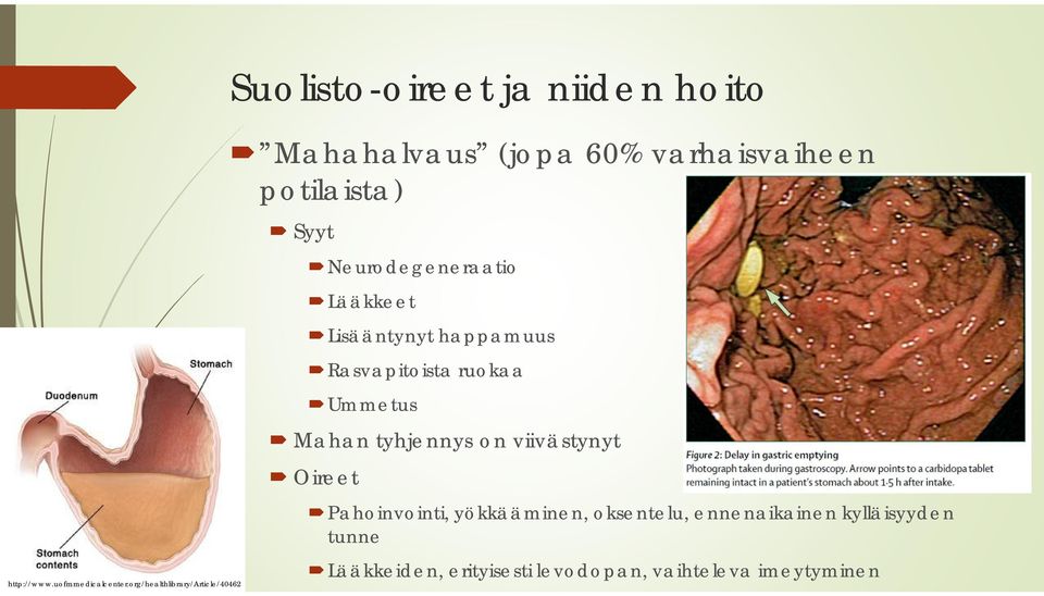 Neurodegeneraatio Lääkkeet Lisääntynyt happamuus Rasvapitoista ruokaa Ummetus Mahan