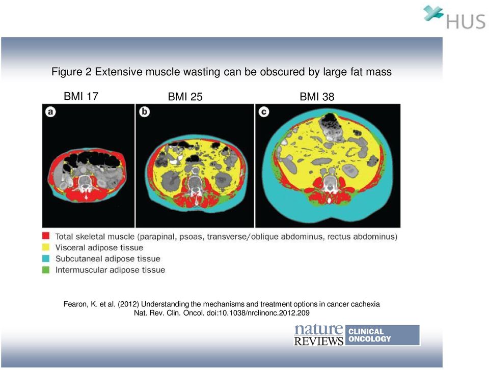 (2012) Understanding the mechanisms and treatment options