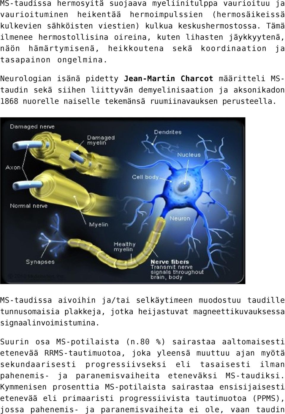 Neurologian isänä pidetty Jean-Martin Charcot määritteli MStaudin sekä siihen liittyvän demyelinisaation ja aksonikadon 1868 nuorelle naiselle tekemänsä ruumiinavauksen perusteella.