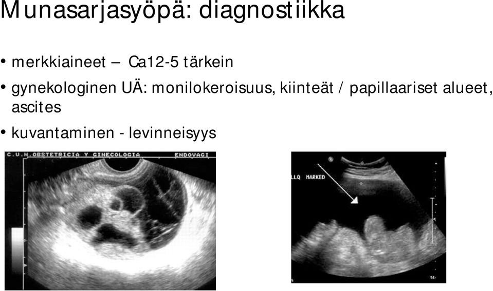 gynekologinen UÄ: monilokeroisuus,