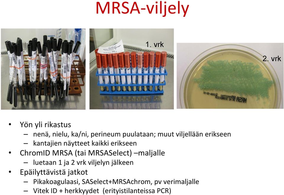 erikseen kantajien näytteet kaikki erikseen ChromID MRSA (tai MRSASelect) maljalle