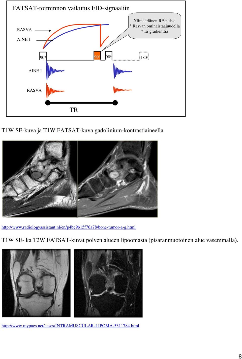 gadolinium-kontrastiaineella http://www.radiologyassistant.nl/en/p4bc9b15f76a78/bone-tumor-a-g.