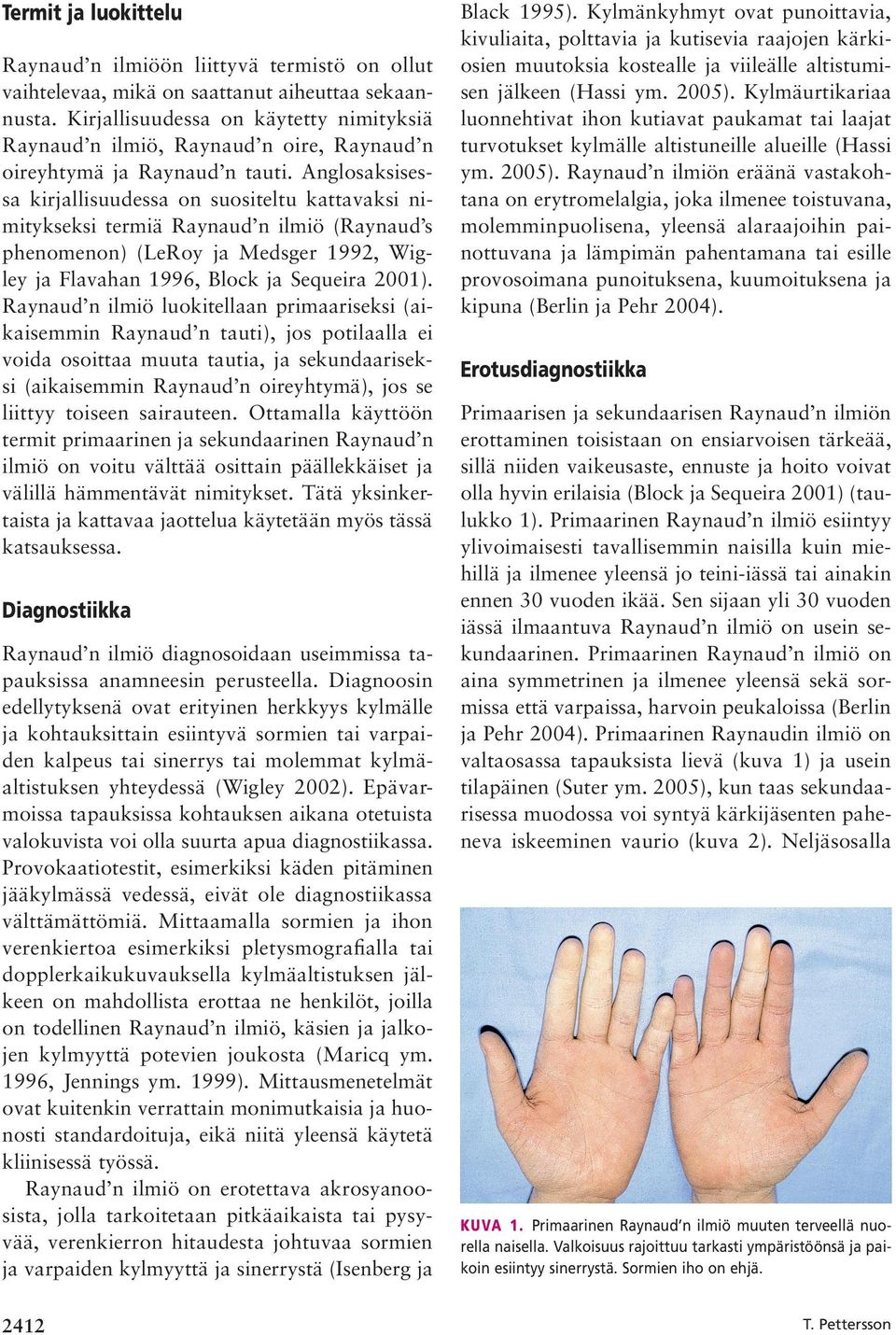 Anglosaksisessa kirjallisuudessa on suositeltu kattavaksi nimitykseksi termiä (Raynaud s phenomenon) (LeRoy ja Medsger 1992, Wigley ja Flavahan 1996, Block ja Sequeira 2001).