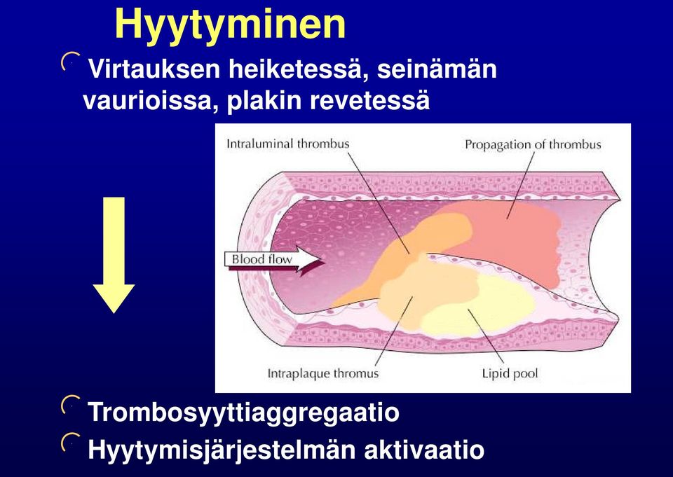vaurioissa, plakin revetessä