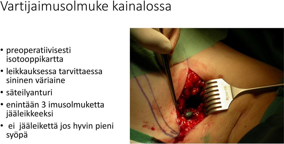 sininen väriaine säteilyanturi enintään 3