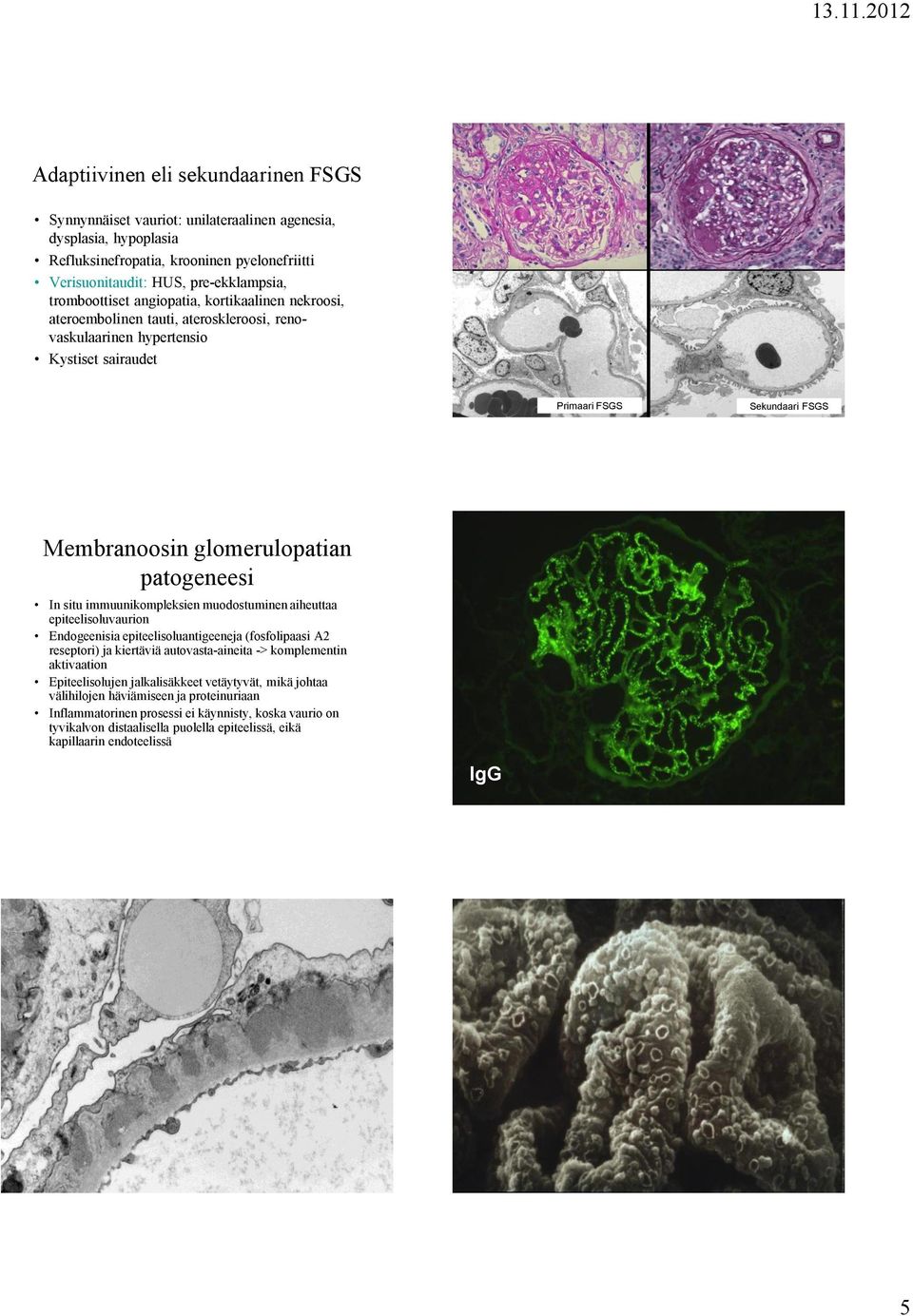 patogeneesi In situ immuunikompleksien muodostuminen aiheuttaa epiteelisoluvaurion Endogeenisia epiteelisoluantigeeneja (fosfolipaasi A2 reseptori) ja kiertäviä autovasta-aineita -> komplementin