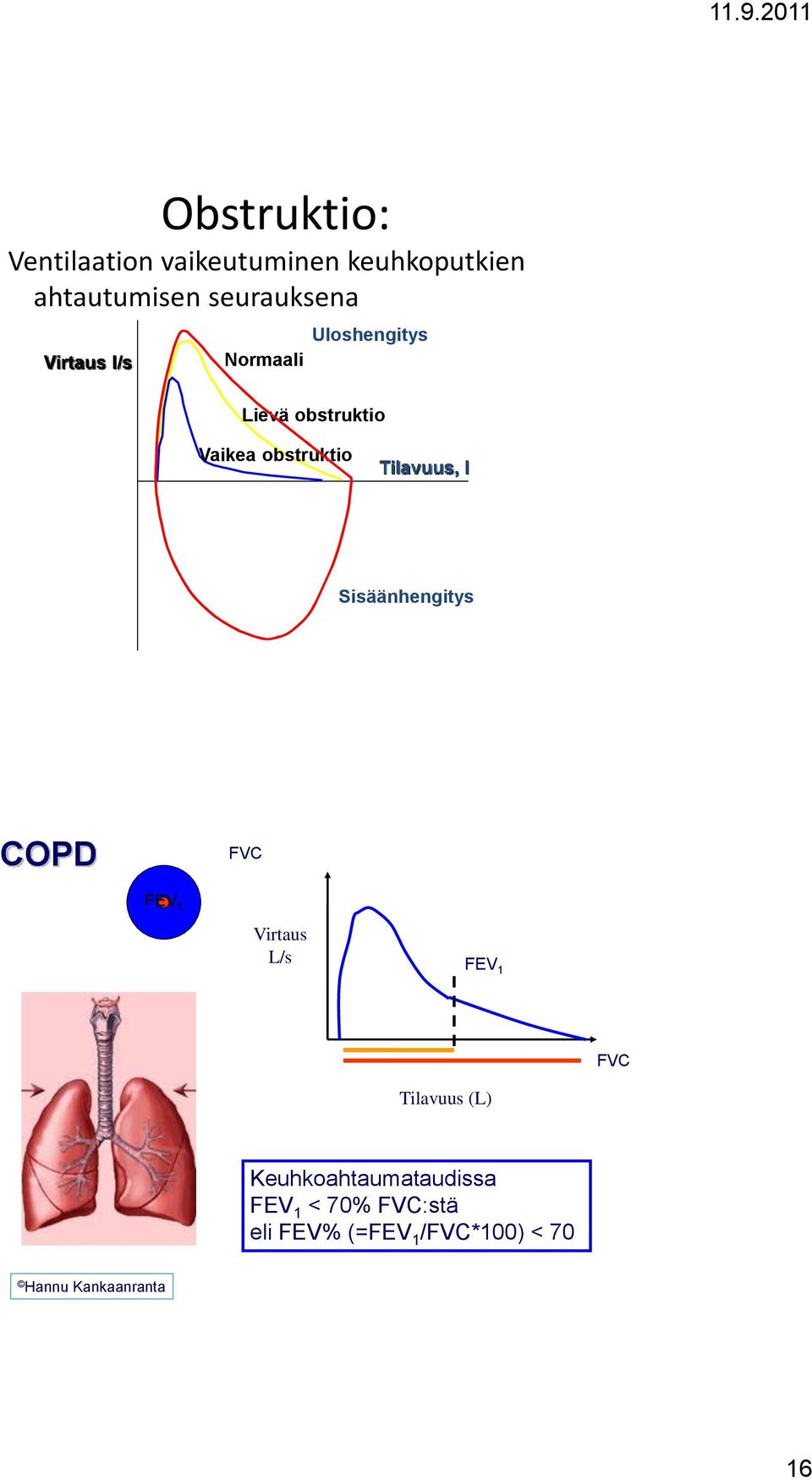 l Sisäänhengitys COPD FVC FEV 1 Virtaus L/s FEV 1 FVC Tilavuus (L)