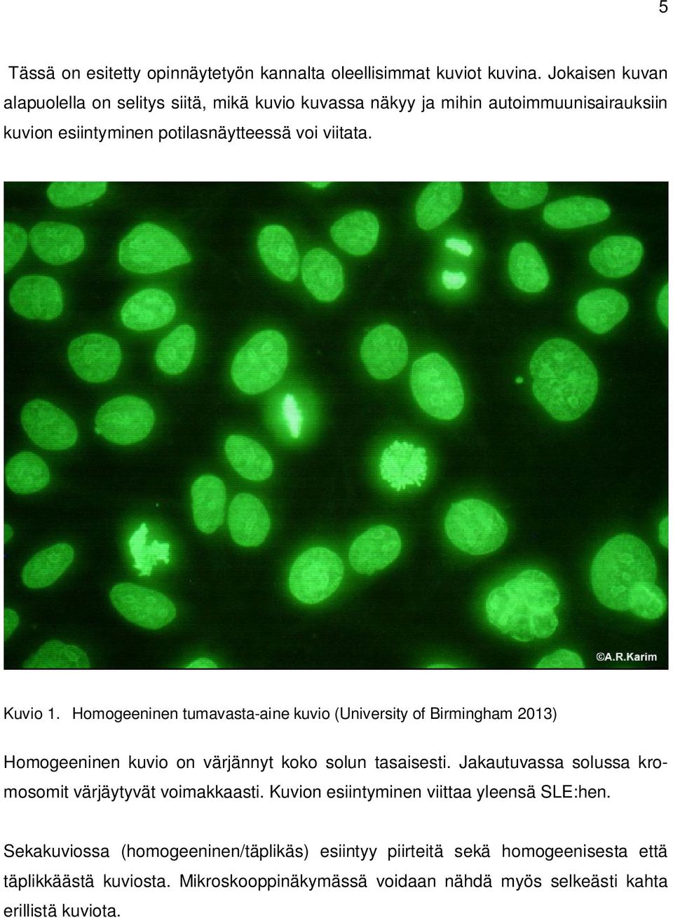 Kuvio 1. Homogeeninen tumavasta-aine kuvio (University of Birmingham 2013) Homogeeninen kuvio on värjännyt koko solun tasaisesti.