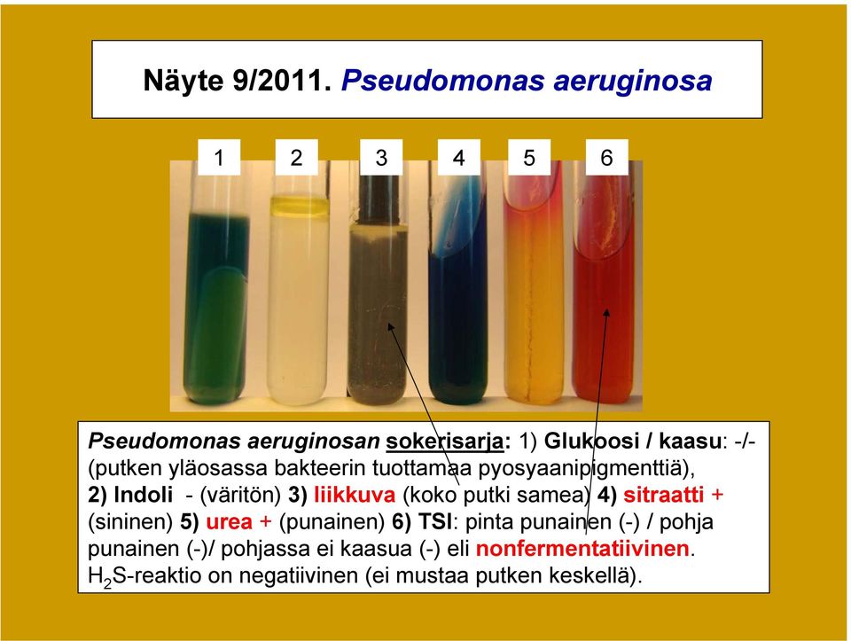 yläosassa bakteerin tuottamaa pyosyaanipigmenttiä), 2) Indoli - (väritön) 3) liikkuva (koko putki samea)