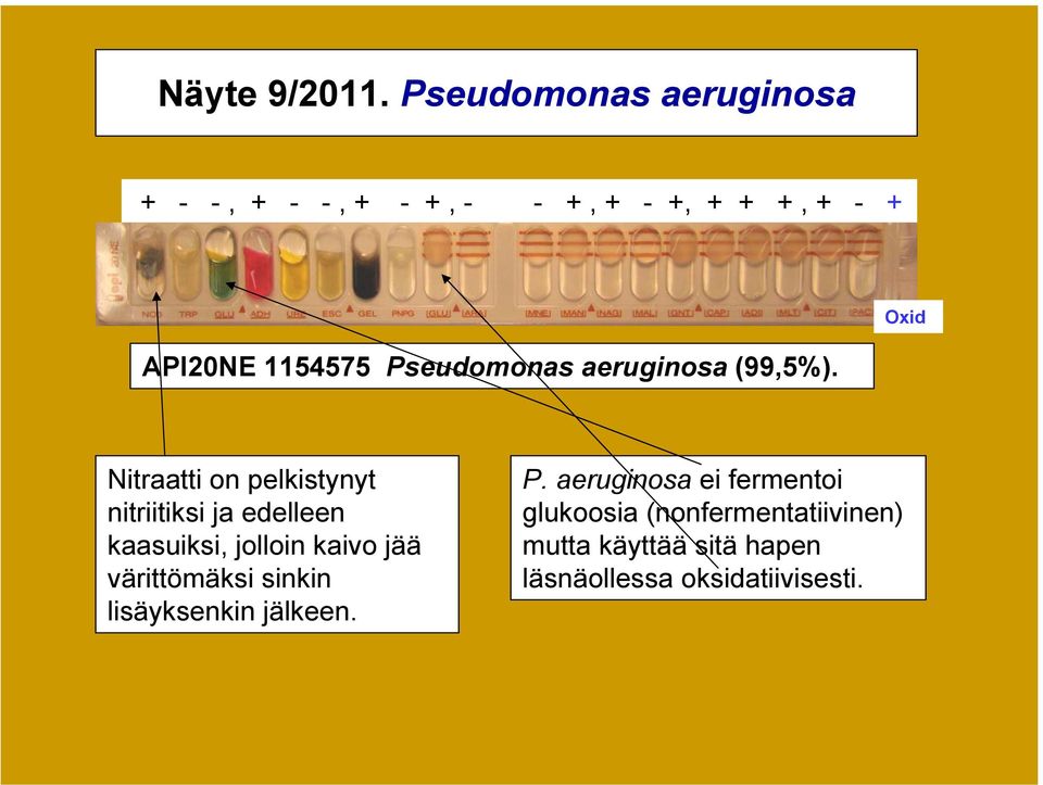 Pseudomonas aeruginosa (99,5%).