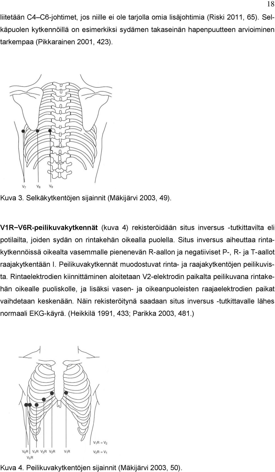 V1R V6R-peilikuvakytkennät (kuva 4) rekisteröidään situs inversus -tutkittavilta eli potilailta, joiden sydän on rintakehän oikealla puolella.