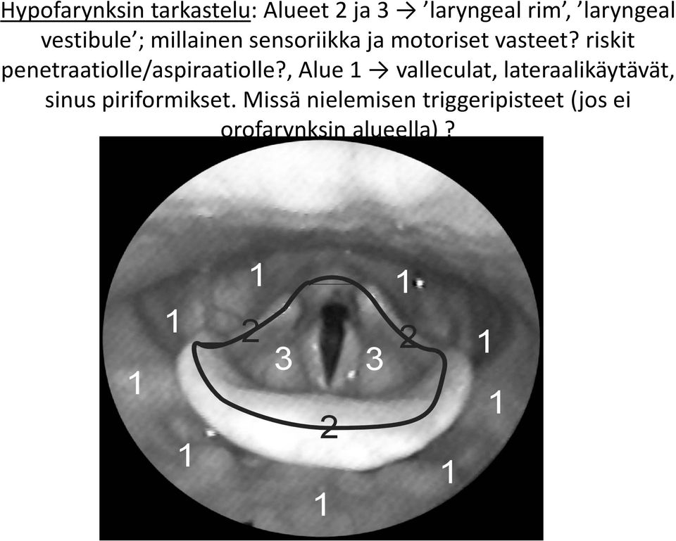 riskit penetraatiolle/aspiraatiolle?