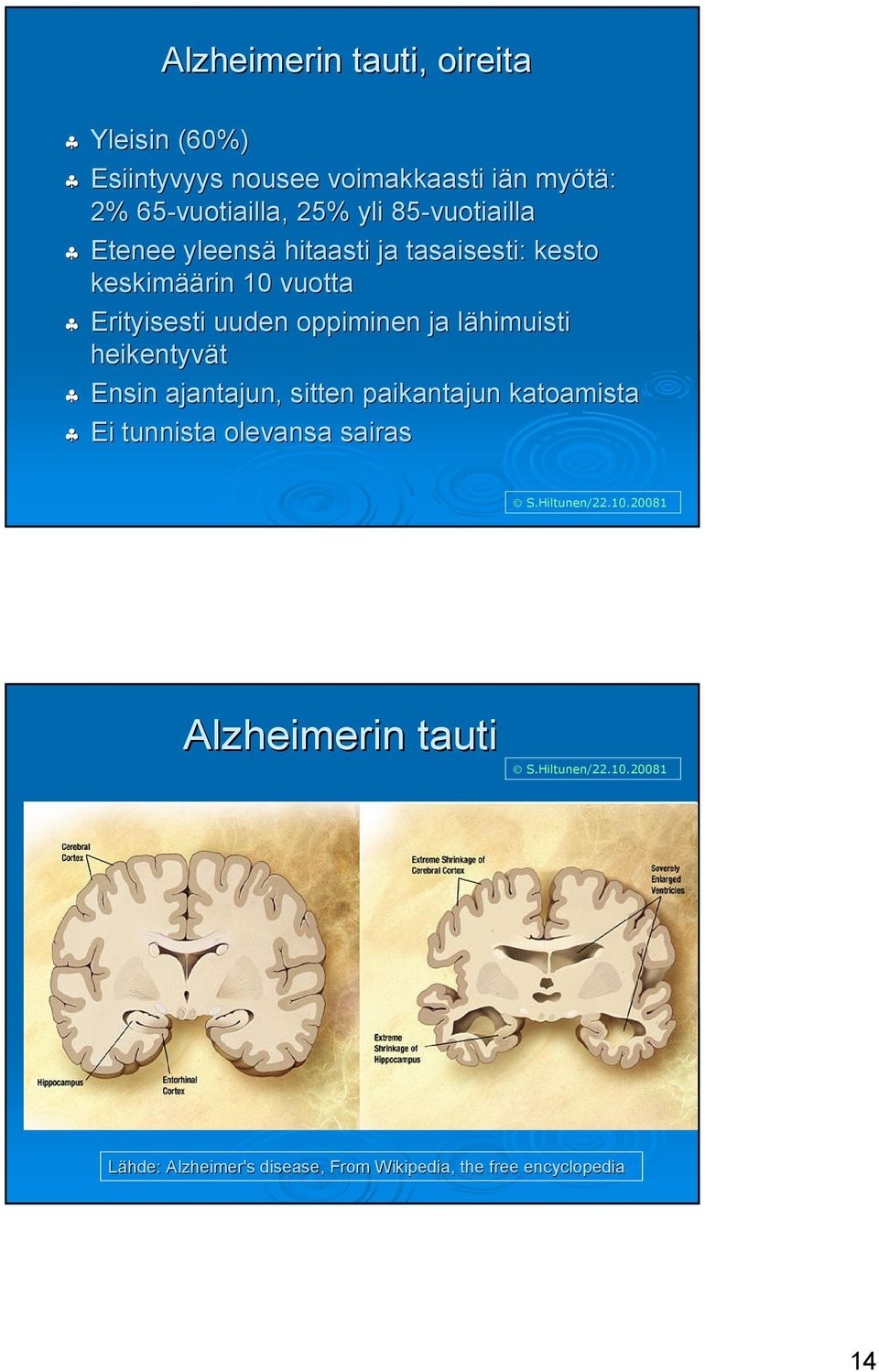 vuotta Erityisesti uuden oppiminen ja lähimuisti l heikentyvät Ensin ajantajun, sitten paikantajun