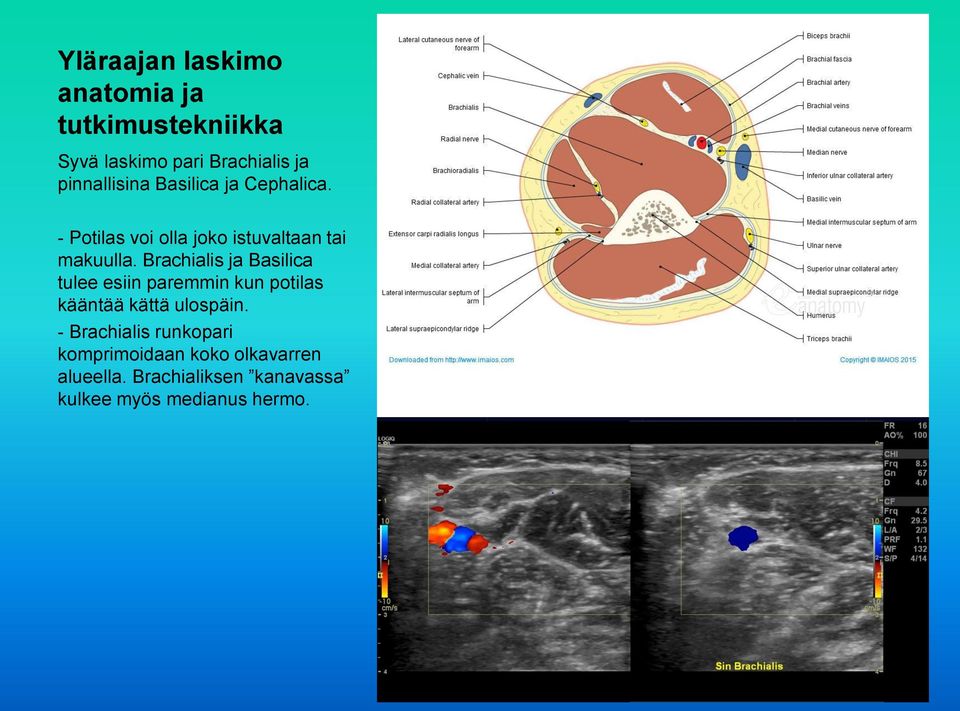 Brachialis ja Basilica tulee esiin paremmin kun potilas kääntää kättä