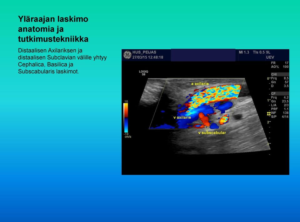 välille yhtyy Cephalica,