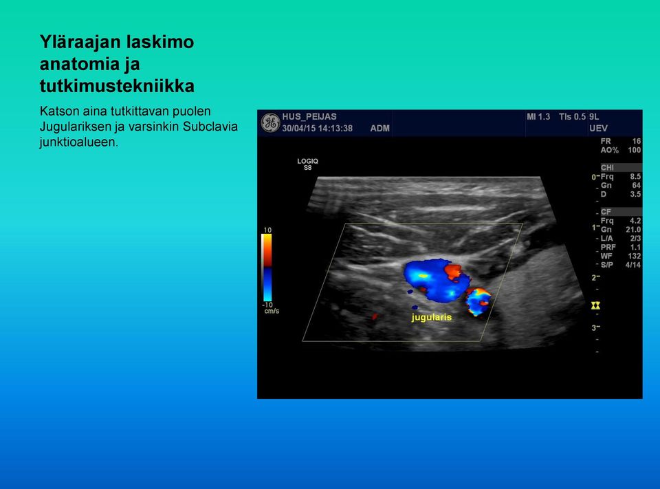 Jugulariksen ja