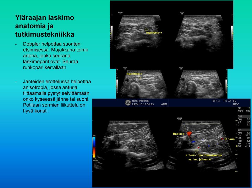 Seuraa runkopari kerrallaan.
