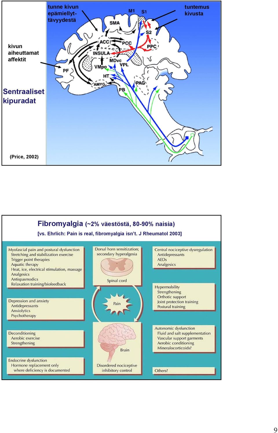 2002) Fibromyalgia (~2% väestöstä, 80-90% naisia) [vs.