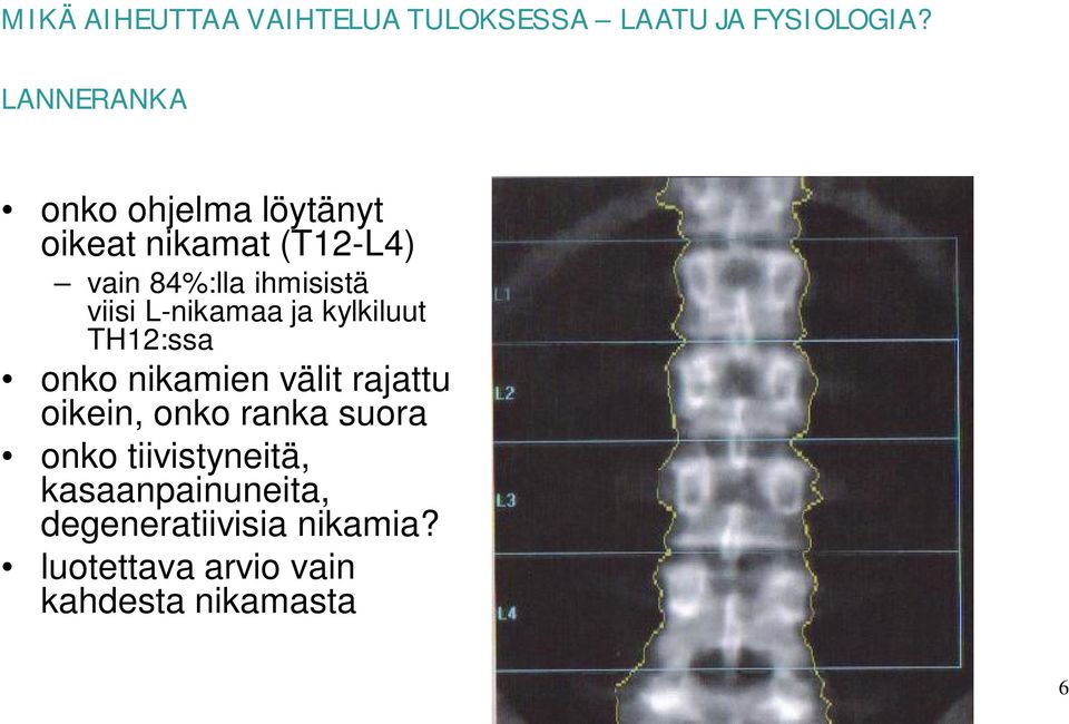 viisi L-nikamaa ja kylkiluut TH12:ssa onko nikamien välit rajattu oikein, onko