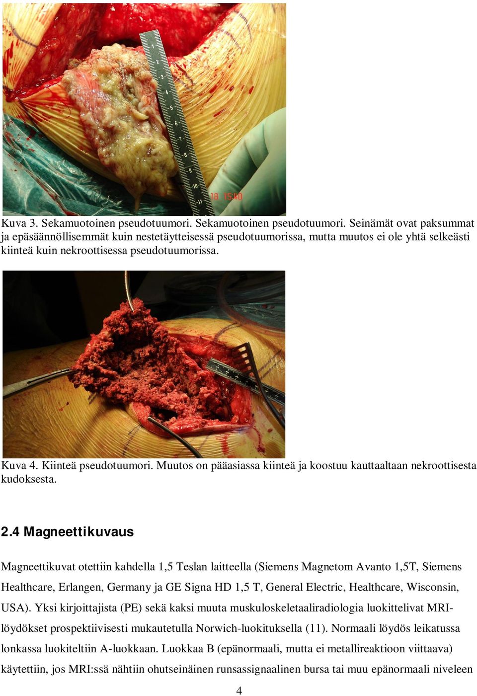 4 Magneettikuvaus Magneettikuvat otettiin kahdella 1,5 Teslan laitteella (Siemens Magnetom Avanto 1,5T, Siemens Healthcare, Erlangen, Germany ja GE Signa HD 1,5 T, General Electric, Healthcare,