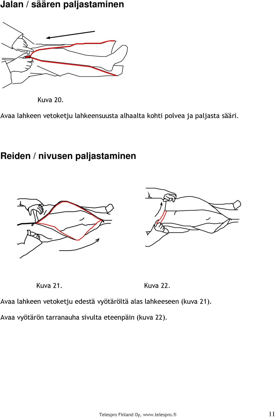 Reiden / nivusen paljastaminen Kuva 21. Kuva 22.