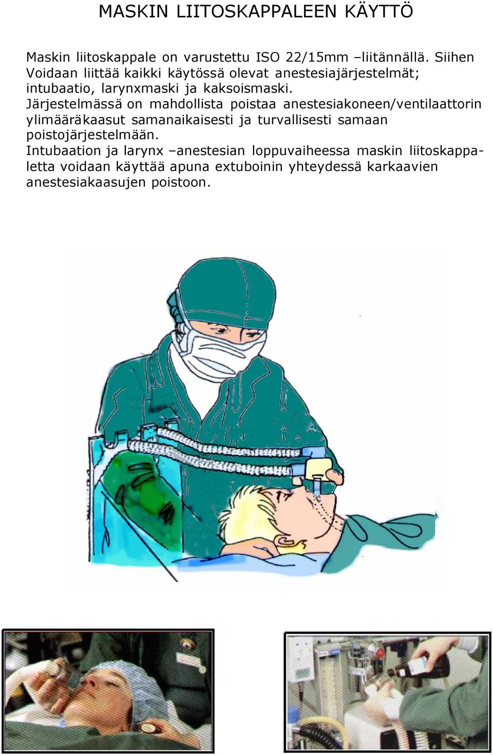 Järjestelmässä on mahdollista poistaa anestesiakoneen/ventilaattorin ylimääräkaasut samanaikaisesti ja turvallisesti samaan