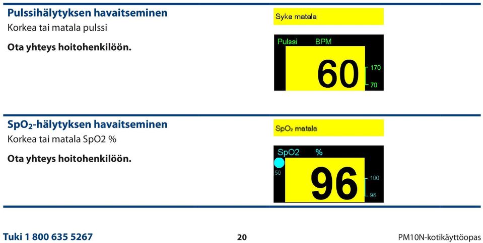 SpO 2 -hälytyksen havaitseminen Korkea tai matala