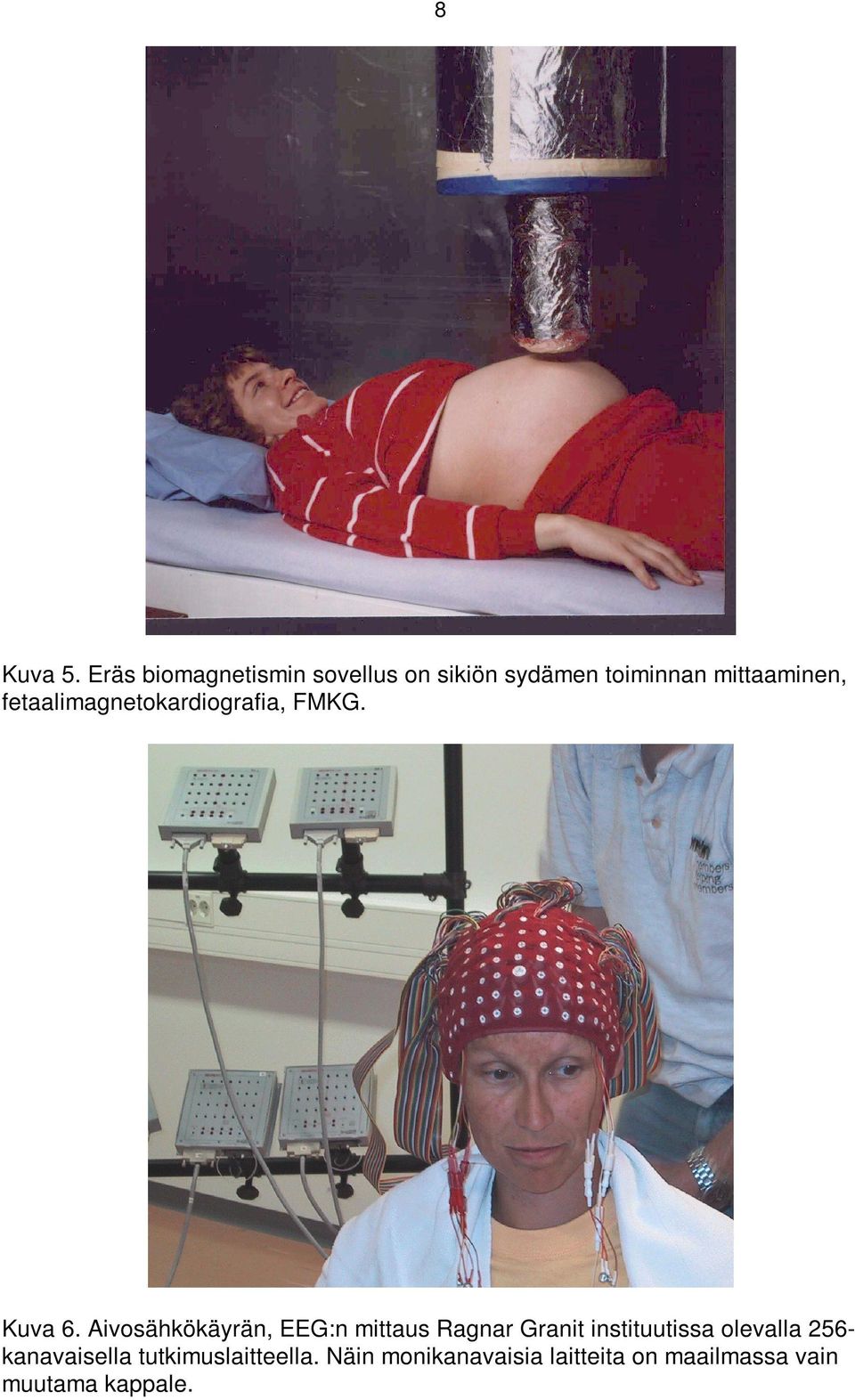 fetaalimagnetokardiografia, FMKG. Kuva 6.