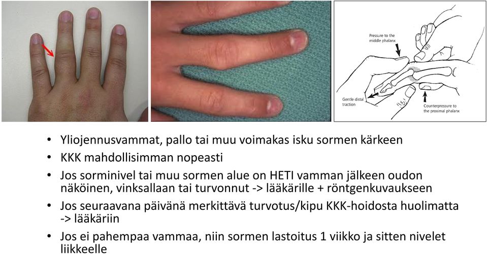 -> lääkärille + röntgenkuvaukseen Jos seuraavana päivänä merkittävä turvotus/kipu KKK-hoidosta