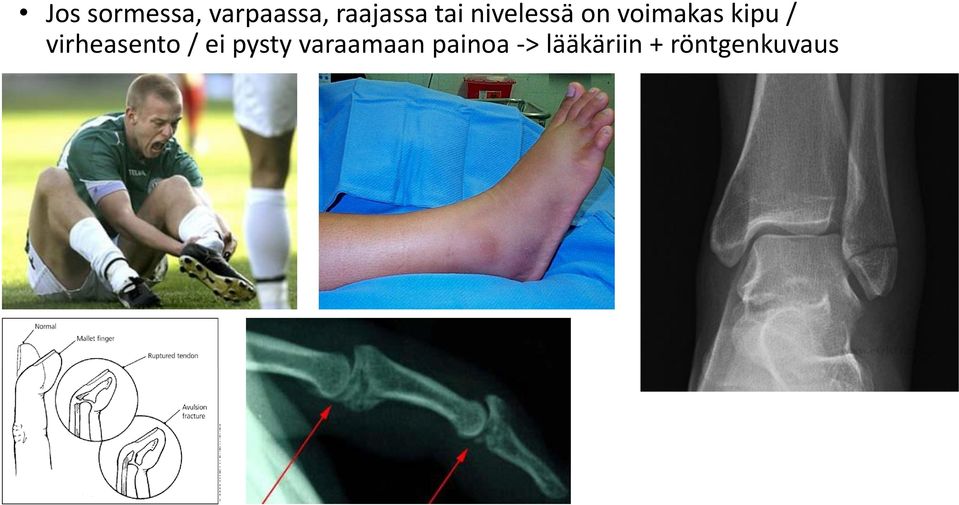 virheasento / ei pysty varaamaan