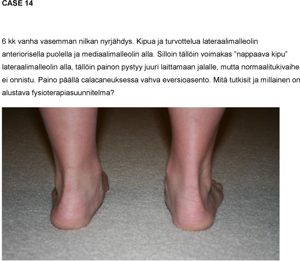 Silloin tällöin voimakas nappaava kipu lateraalimalleolin alla, tällöin painon pystyy juuri