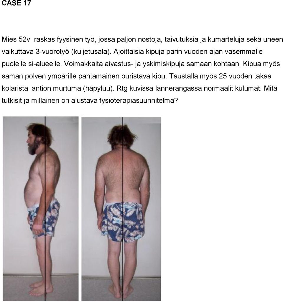 Ajoittaisia kipuja parin vuoden ajan vasemmalle puolelle si-alueelle. Voimakkaita aivastus- ja yskimiskipuja samaan kohtaan.