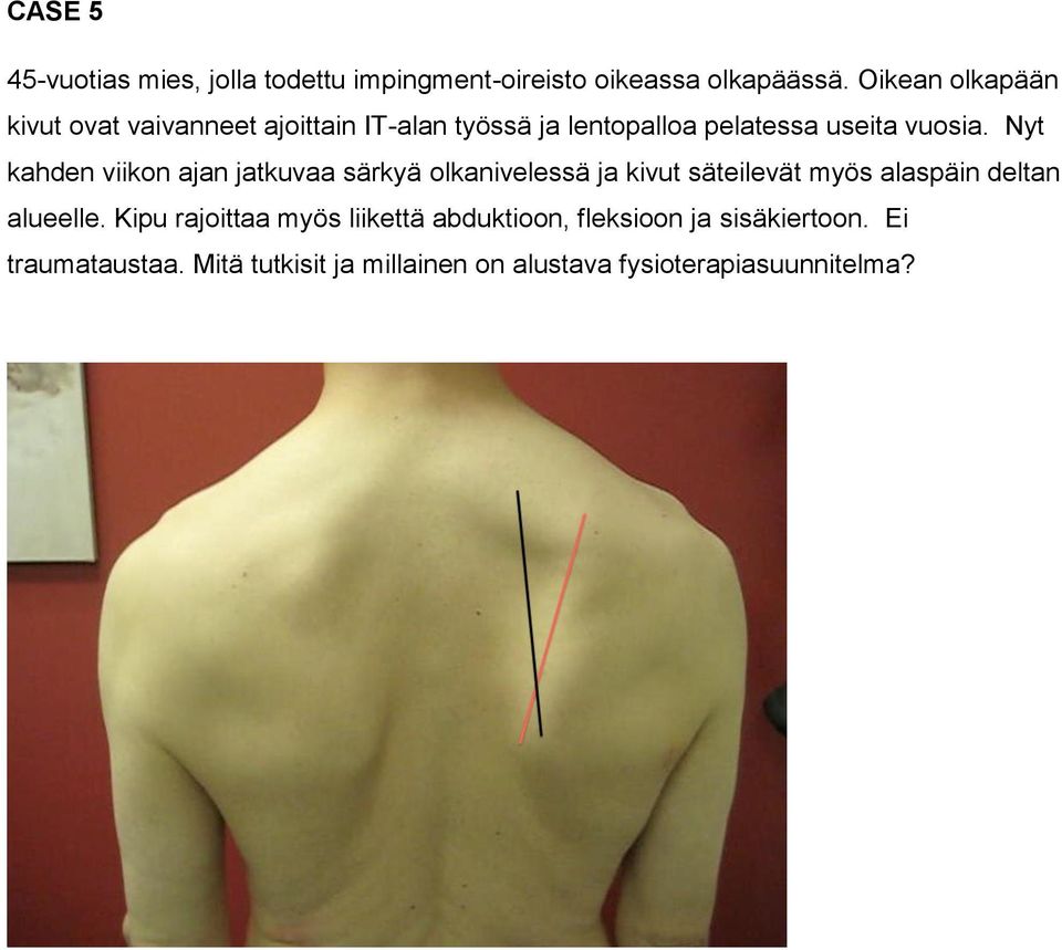 Nyt kahden viikon ajan jatkuvaa särkyä olkanivelessä ja kivut säteilevät myös alaspäin deltan alueelle.