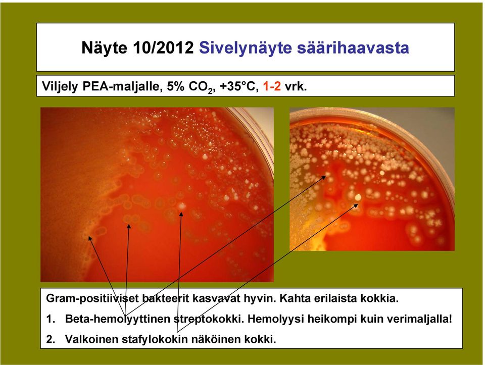 Kahta erilaista kokkia. 1. Beta-hemolyyttinen streptokokki.