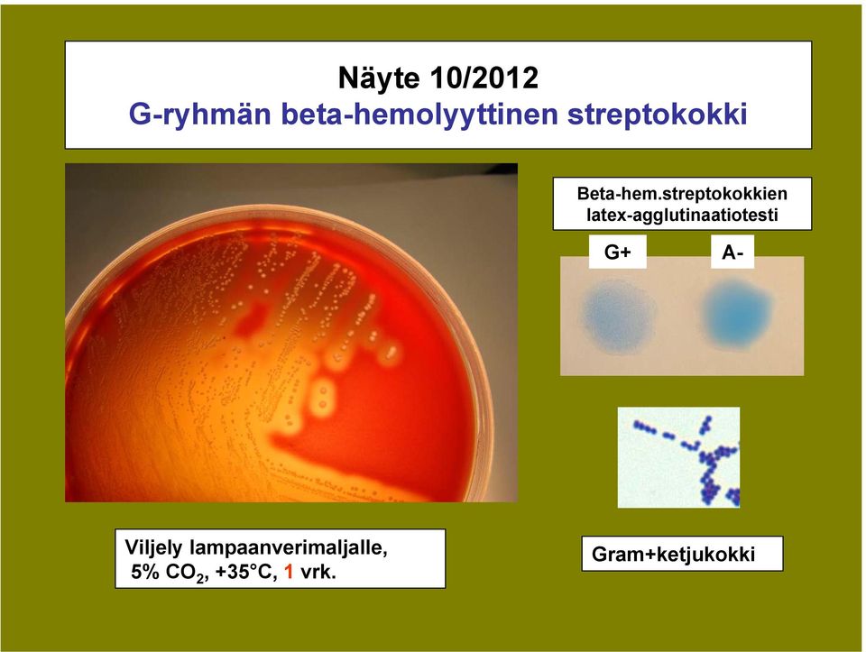 streptokokkien latex-agglutinaatiotesti G+