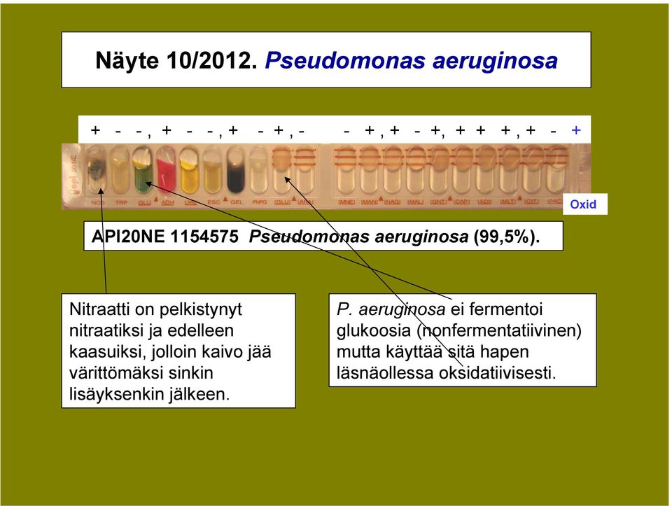 Pseudomonas aeruginosa (99,5%).