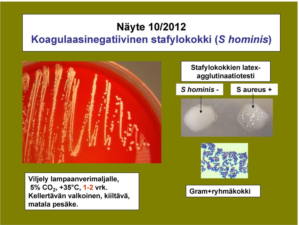 S aureus + Viljely lampaanverimaljalle, 5% CO 2, +35 C, 1-2