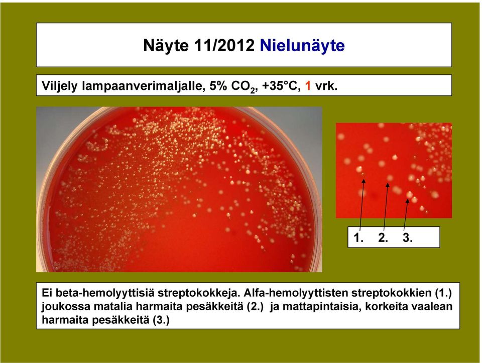 Alfa-hemolyyttisten streptokokkien (1.