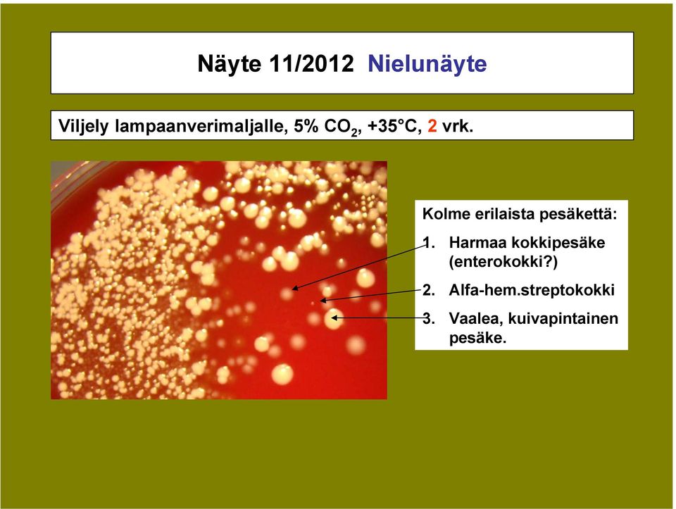 Kolme erilaista pesäkettä: 1.