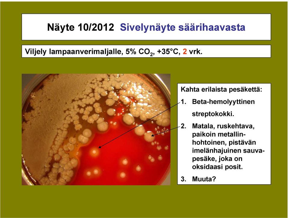 Beta-hemolyyttinen streptokokki. 2.