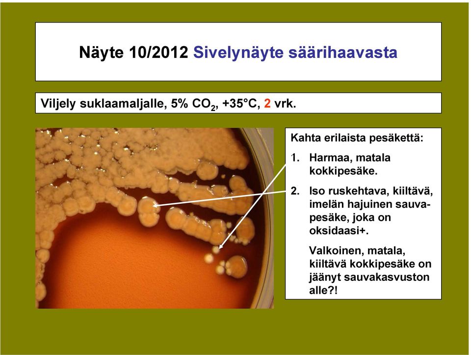 vrk. Kahta erilaista pesäkettä: 1. Harmaa, matala kokkipesäke. 2.