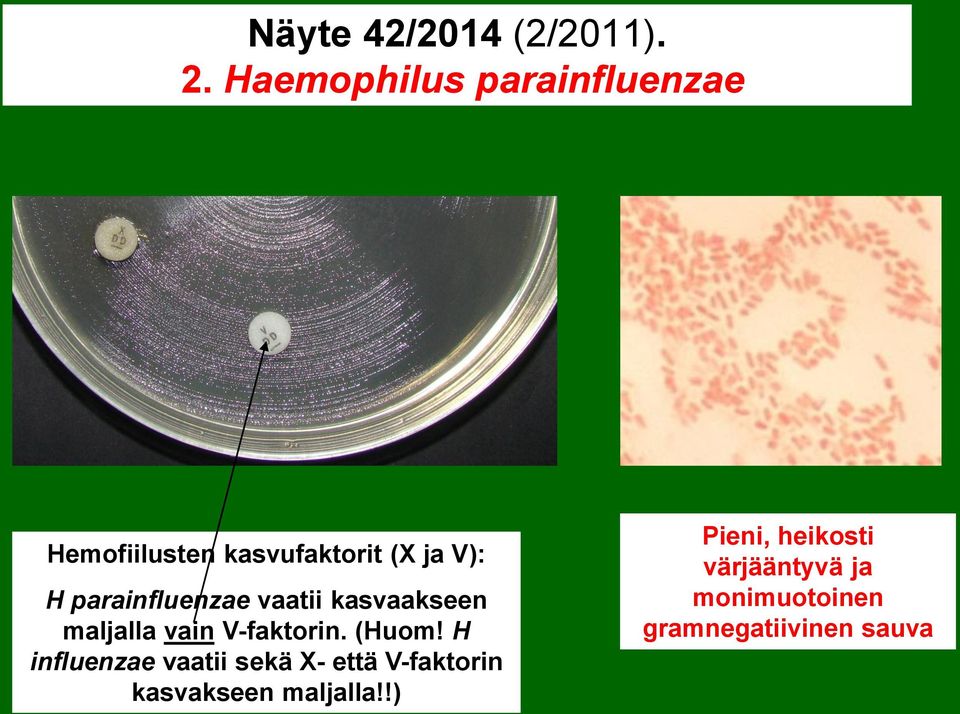 parainfluenzae vaatii kasvaakseen maljalla vain V-faktorin. (Huom!