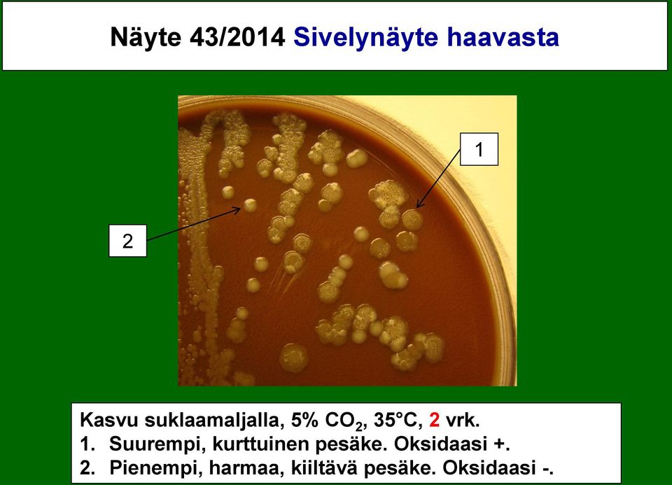 Suurempi, kurttuinen pesäke. Oksidaasi +. 2.