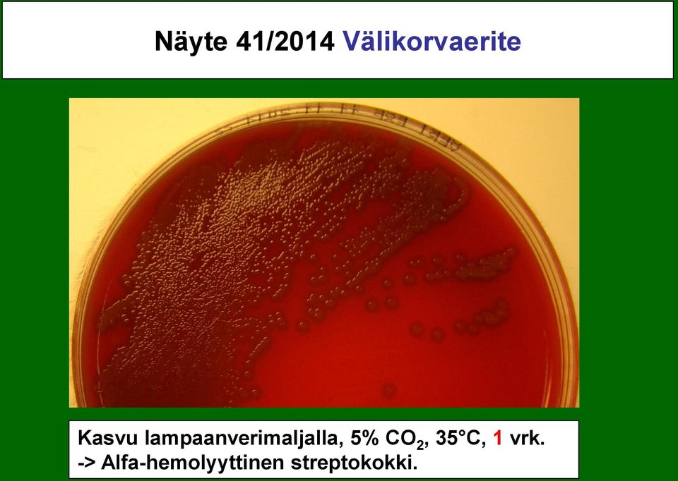 5% CO 2, 35 C, 1 vrk.