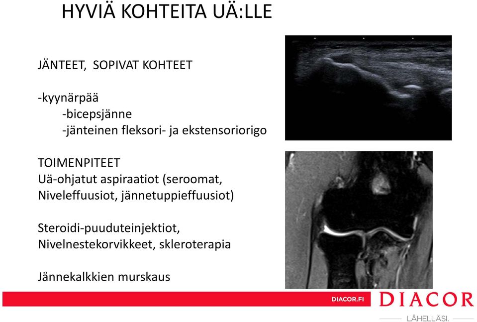 aspiraatiot (seroomat, Niveleffuusiot, jännetuppieffuusiot) Steroidi