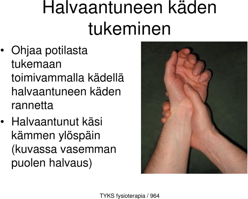 halvaantuneen käden rannetta Halvaantunut