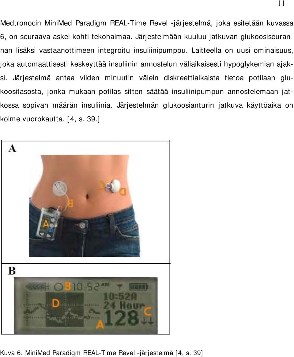 Laitteella on uusi ominaisuus, joka automaattisesti keskeyttää insuliinin annostelun väliaikaisesti hypoglykemian ajaksi.