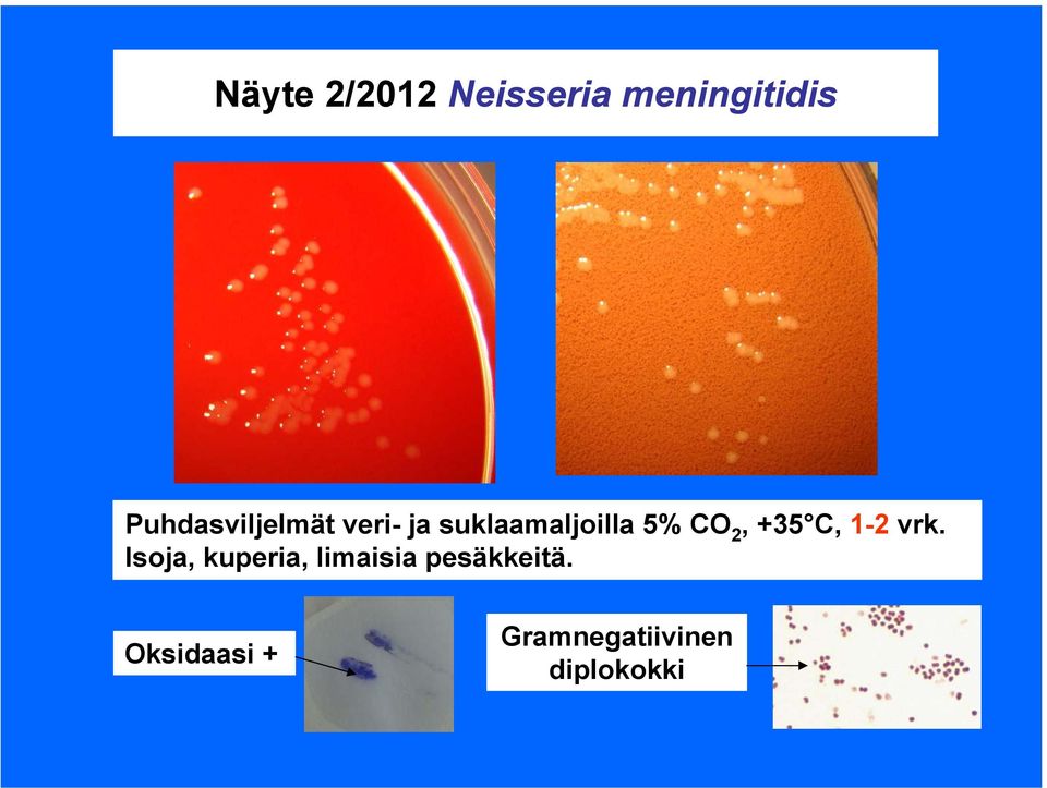 CO 2, +35 C, 1-2 vrk.