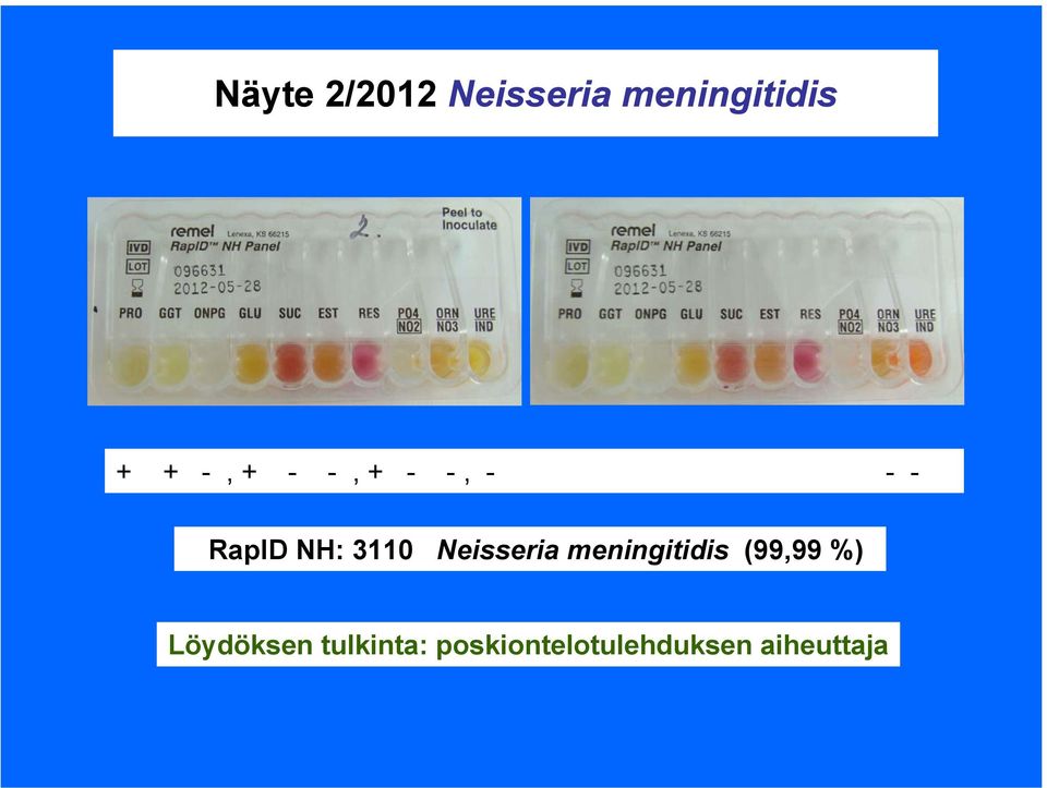 Neisseria meningitidis (99,99 %)